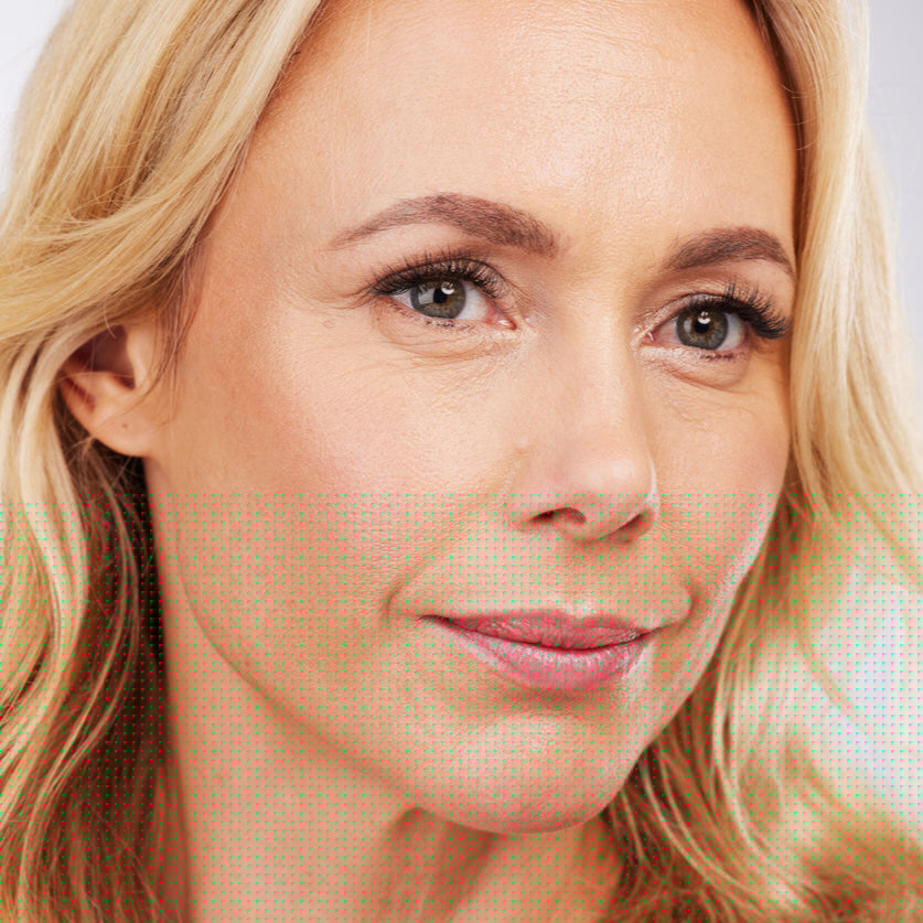 Aging + Fine Lines